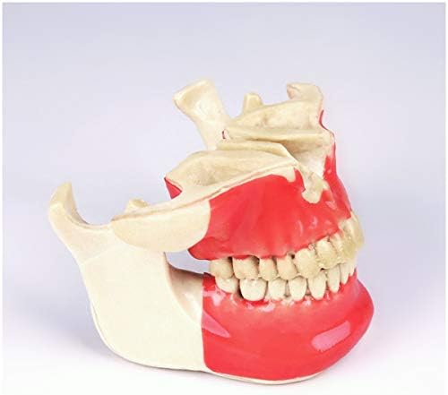 KH66ZKY Nastavni model zuba Zubni implantat bolest zubi Model studentskih smola materijala za usmenu nastavu