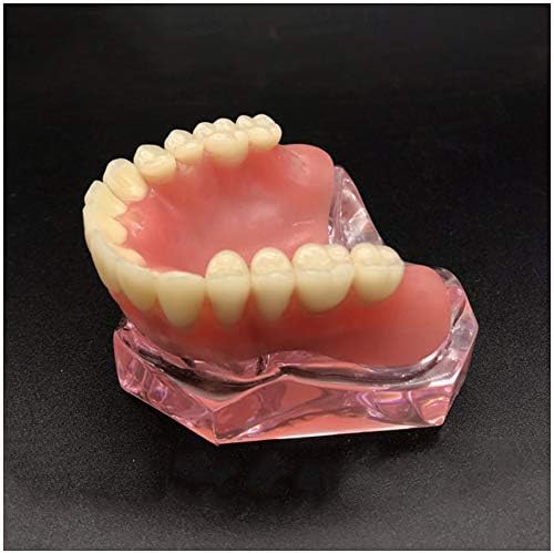 KH66ZKY prozirni zubi Model Overdenture Gornji zubi 4 implantata Demo zubni model zuba za studij Standardni