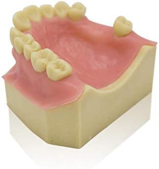 Model prakse implantat Lemita - zubni zubi Model meko desni demonstracijski model zuba za školovanje za