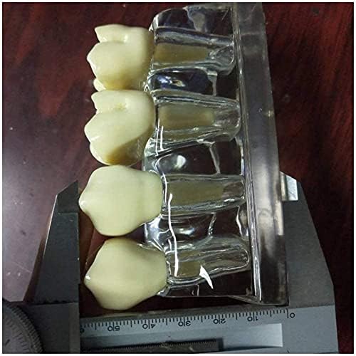 PSVO-ov model za nastavu, model zuba - zubi Model zatvaranja zuba - zubi Anti-Wormworm sprječavaju karijere